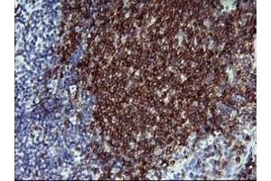 Image no. 1 for anti-CD22 Molecule (CD22) antibody (ABIN1497211) (CD22 抗体)