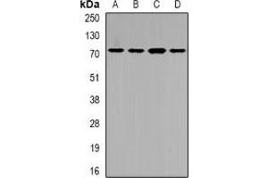 Western blot analysis of SLC22A11 expression in SW620 (A), HepG2 (B), mouse liver (C), rat kidney (D) whole cell lysates.