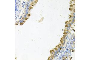 Immunohistochemistry of paraffin-embedded mouse lung using KLK11 antibody (ABIN5975048) at dilution of 1/100 (40x lens). (Kallikrein 11 抗体)