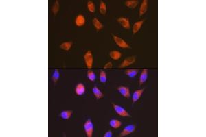 Immunofluorescence analysis of HeLa cells using LGR6 Rabbit mAb (ABIN7268235) at dilution of 1:100 (40x lens). (LGR6 抗体)