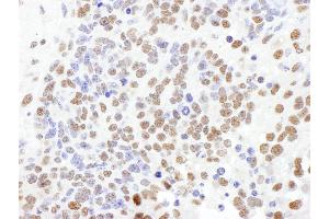 Immunohistochemistry (IHC) image for anti-Splicing Factor 1 (SF1) (AA 25-75) antibody (ABIN7453644)