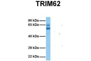 Host:  Rabbit  Target Name:  TRIM62  Sample Tissue:  Human Ovary Tumor  Antibody Dilution:  1. (TRIM62 抗体  (N-Term))