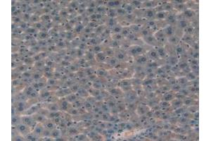 IHC-P analysis of Mouse Liver Tissue, with DAB staining. (IGFBP7 抗体  (AA 88-281))
