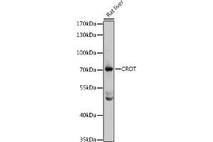 Western blot analysis of extracts of rat liver, using CROT antibody (ABIN1679365, ABIN3019208, ABIN3019209 and ABIN6220764) at 1:3000 dilution. (CROT 抗体  (AA 1-87))