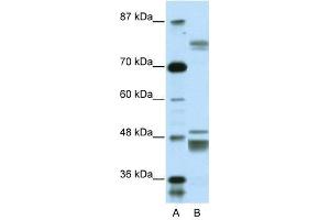 ZNF607 antibody used at 0. (ZNF607 抗体  (Middle Region))