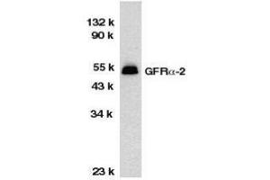 Western Blotting (WB) image for anti-GDNF Family Receptor alpha 2 (GFRA2) (C-Term) antibody (ABIN2473789) (GFRA2 抗体  (C-Term))
