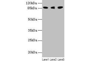 Western blot All lanes: Loxl2 antibody at 14 μg/mL Lane 1: 293T whole cell lysate Lane 2: A549 whole cell lysate Lane 3: A431 whole cell lysate Secondary Goat polyclonal to rabbit IgG at 1/10000 dilution Predicted band size: 88, 82 kDa Observed band size: 88 kDa (LOXL2 抗体  (AA 26-776))
