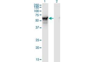 Western Blot analysis of NMT2 expression in transfected 293T cell line by NMT2 monoclonal antibody (M01), clone S1. (NMT2 抗体  (AA 1-498))