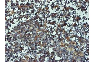 Immunostaining (ISt) image for anti-Proteasome (Prosome, Macropain) Subunit, beta Type, 6 (PSMB6) (AA 1-239) antibody (ABIN562481)