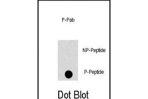 Dot blot analysis of anti-PK8-p Phospho-specific Pab (ABIN389822 and ABIN2839706) on nitrocellulose membrane. (JNK 抗体  (pThr183))