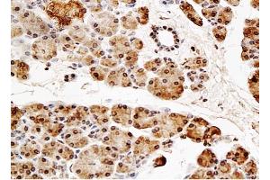 Formalin-fixed and paraffin embedded rat pancreas tissue labeled with Anti-NT5C2 Polyclonal Antibody, Unconjugated (ABIN739353) onjugated (NT5C2 抗体  (AA 1-100))