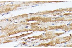 Immunohistochemistry of paraffin-embedded Rat heart using NUBP1 Polyclonal Antibody at dilution of 1:100 (40x lens). (NUBP1 抗体)