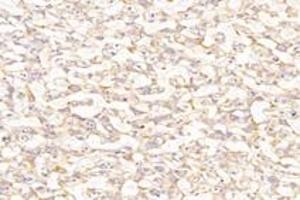 Immunohistochemistry analysis of paraffin-embedded rat placenta using,PTGFR (ABIN7075209) at dilution of 1: 800 (PTGFR 抗体)