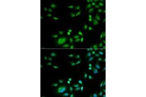 Immunofluorescence analysis of A549 cell using INTS10 antibody. (INTS10 抗体)