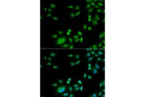 Immunofluorescence analysis of A549 cell using INTS10 antibody.