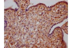 Recombinant Growth Hormone Receptor 抗体