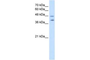 Western Blotting (WB) image for anti-Pregnancy Specific beta-1-Glycoprotein 1 (PSG1) antibody (ABIN2462567) (PSG1 抗体)