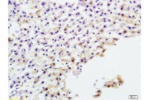 Formalin-fixed and paraffin embedded rat liver tissue labeled with Anti-AP-TNAP/ALP Polyclonal Antibody, Unconjugated  at 1:200 followed by conjugation to the secondary antibody and DAB staining (ALPL 抗体  (AA 52-150))