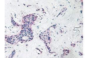 Image no. 6 for anti-Platelet Factor 4 (PF4) antibody (ABIN465152) (PF4 抗体)