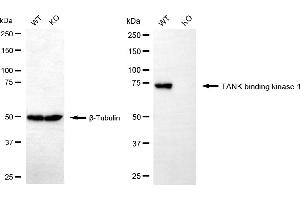 Western blotting analysis using TANK binding kinase 1 antibody (ABIN7800508). (Recombinant TBK1 抗体)