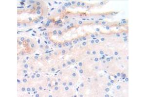 IHC-P analysis of Mouse Tissue, with DAB staining. (IL2 Receptor beta 抗体  (AA 27-240))