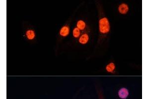 Immunofluorescence (IF) image for anti-Methyltransferase Like 3 (METTL3) antibody (ABIN7264399)