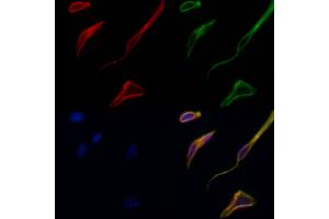 ABIN6257619 and ABIN6275298 staining Hela cells by IF/ICC. (Neurexophilin 4 抗体  (Internal Region))