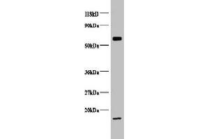 Western blot All lanes: COX5B antibody at 2 μg/mL + EC109 whole cell lysate Secondary Goat polyclonal to rabbit IgG at 1/15000 dilution Predicted band size: 14 kDa Observed band size: 14, 65 kDa (COX5B 抗体  (AA 32-129))