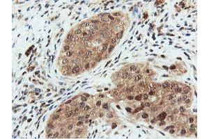 Image no. 8 for anti-Dual Specificity Phosphatase 23 (DUSP23) antibody (ABIN1497930) (DUSP23 抗体)