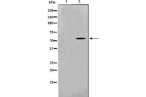 Western blot analysis of Src expression in 293 whole cell lysates,The lane on the left is treated with the antigen-specific peptide. (Src 抗体)