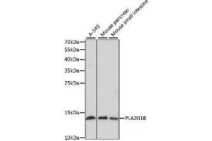 Western blot analysis of extracts of various cell lines using PLA2G1B Polyclonal Antibody at dilution of 1:1000. (PLA2G1B 抗体)