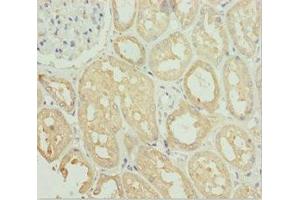 Immunohistochemistry of paraffin-embedded human kidney tissue using ABIN7171149 at dilution of 1:100 (SNAP29 抗体  (AA 1-258))