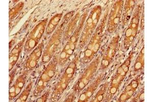Immunohistochemistry of paraffin-embedded human small intestine tissue using ABIN7160177 at dilution of 1:100