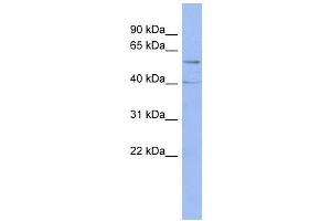 PPP2R5C antibody used at 1 ug/ml to detect target protein. (PPP2R5C 抗体  (Middle Region))