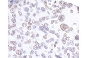 Immunohistochemistry (IHC) image for anti-Apoptosis Inhibitor 5 (API5) (AA 1-50) antibody (ABIN7453657) (Apoptosis Inhibitor 5 抗体  (AA 1-50))