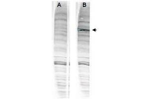 Image no. 2 for anti-Werner Helicase Interacting Protein 1 (WRNIP1) (Internal Region) antibody (ABIN401271) (WRNIP1 抗体  (Internal Region))