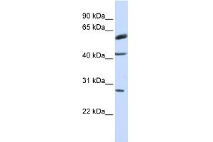 WB Suggested Anti-RNF170 Antibody Titration:  0. (RNF170 抗体  (Middle Region))
