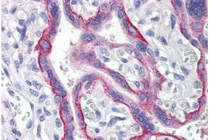 Human Placenta (formalin-fixed, paraffin-embedded) stained with LRRC1 antibody ABIN214508 at 5 ug/ml followed by biotinylated goat anti-rabbit IgG secondary antibody ABIN481713, alkaline phosphatase-streptavidin and chromogen. (LRRC1 抗体  (C-Term))
