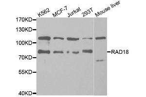 Western Blotting (WB) image for anti-E3 ubiquitin-protein ligase RAD18 (RAD18) antibody (ABIN1876568) (RAD18 抗体)