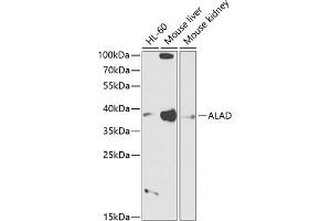 Western blot analysis of extracts of various cell lines, using ALAD antibody (ABIN6129891, ABIN6136749, ABIN6136751 and ABIN6216012) at 1:1000 dilution. (ALAD 抗体  (AA 1-330))