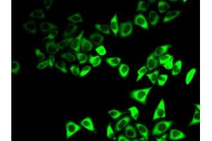 Immunofluorescence analysis of HeLa cells using IGFBP5 antibody (ABIN6130486, ABIN6142258, ABIN6142260 and ABIN6218003). (IGFBP5 抗体  (AA 21-272))