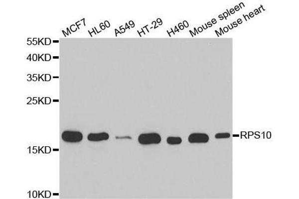 RPS10 抗体  (AA 1-165)