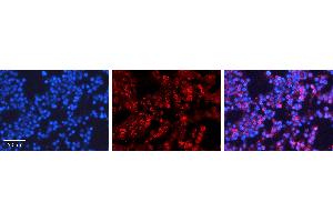 Immunohistochemistry (IHC) image for anti-Promyelocytic Leukemia (PML) (C-Term) antibody (ABIN2777721)
