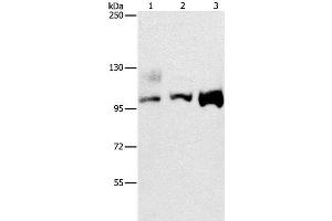Western Blot analysis of A431, 293T and hela cell using ASCC2 Polyclonal Antibody at dilution of 1:500 (ASCC2 抗体)