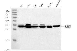 anti-VAMP (Vesicle-Associated Membrane Protein)-Associated Protein A, 33kDa (VAPA) (N-Term) antibody