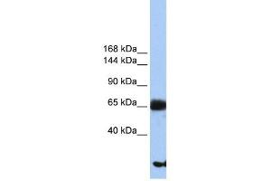 PIGO antibody used at 1 ug/ml to detect target protein. (IGLL1 抗体  (N-Term))