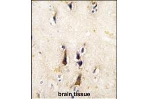 Formalin-fixed and paraffin-embedded human brain tissue reacted with BACE1 antibody (N-term), which was peroxidase-conjugated to the secondary antibody, followed by DAB staining. (BACE1 抗体  (N-Term))
