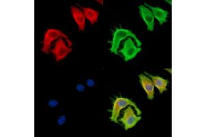 ABIN7095009 and ABIN7099065 staining HepG2 cells by IF/ICC. (NAT15 抗体)