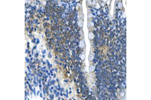 IHC analysis of PAR4/Pawr using anti-PAR4/Pawr antibody (ABIN7599938).