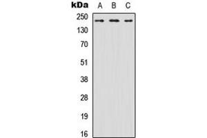 Western blot analysis of Nav1. (SCN8A 抗体  (N-Term))